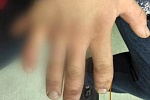 Зеленоградка опознала насильника по количеству пальцев на его руках